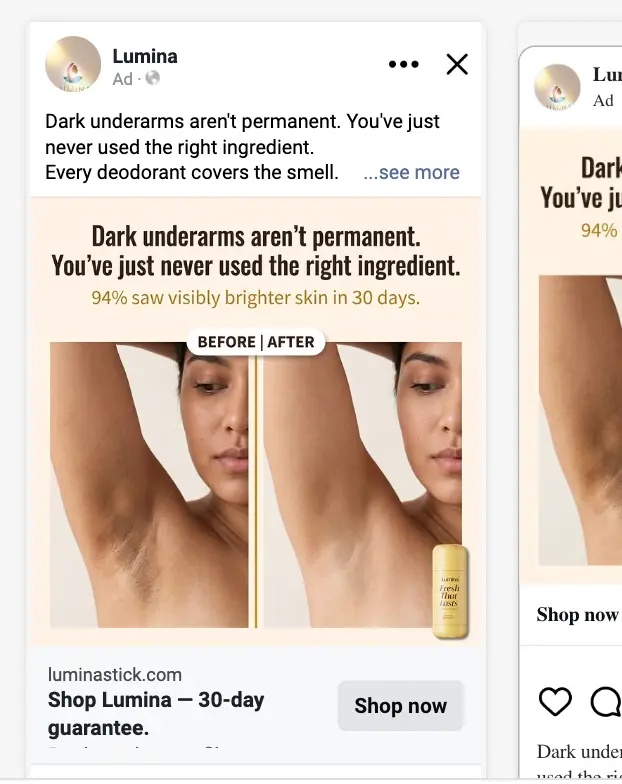 Static ad